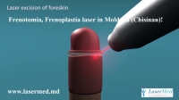 Frenotomia, Frenoplastia laser in Moldova Chisinau!