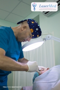 Blefaroplastia cu Laser - Corectarea Pleoapelor